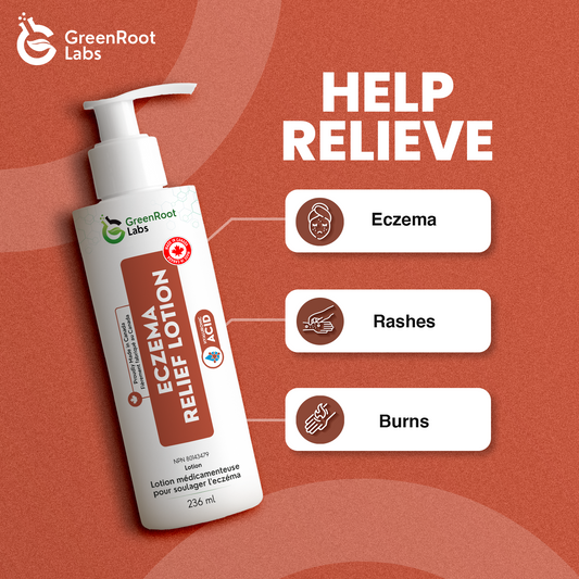 Medicated Eczema/Rash Relief Lotion